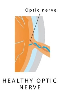 Optic-nerve-200.jpg